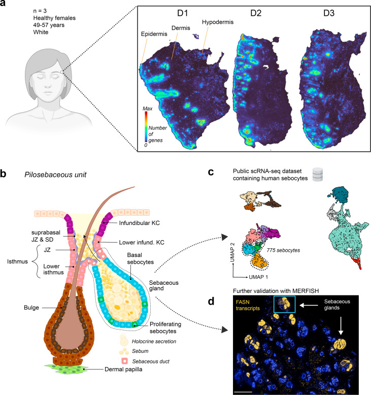 High-Resolution Spatial Map of the Human Facial Sebaceous Gland Reveals Marker Genes and Decodes Sebocyte Differentiation