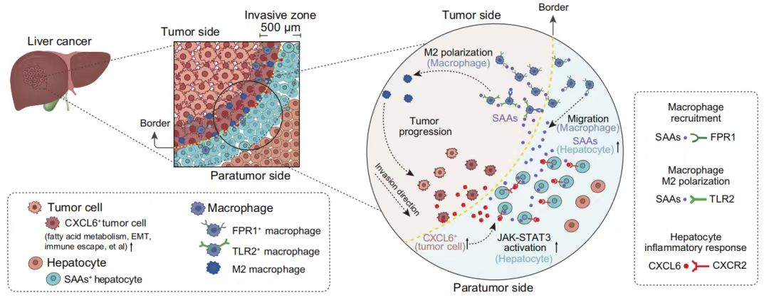 Stereo-seq揭示人类肝癌浸润区促进肝细胞-肿瘤细胞串扰、局部免疫抑制和肿瘤进展