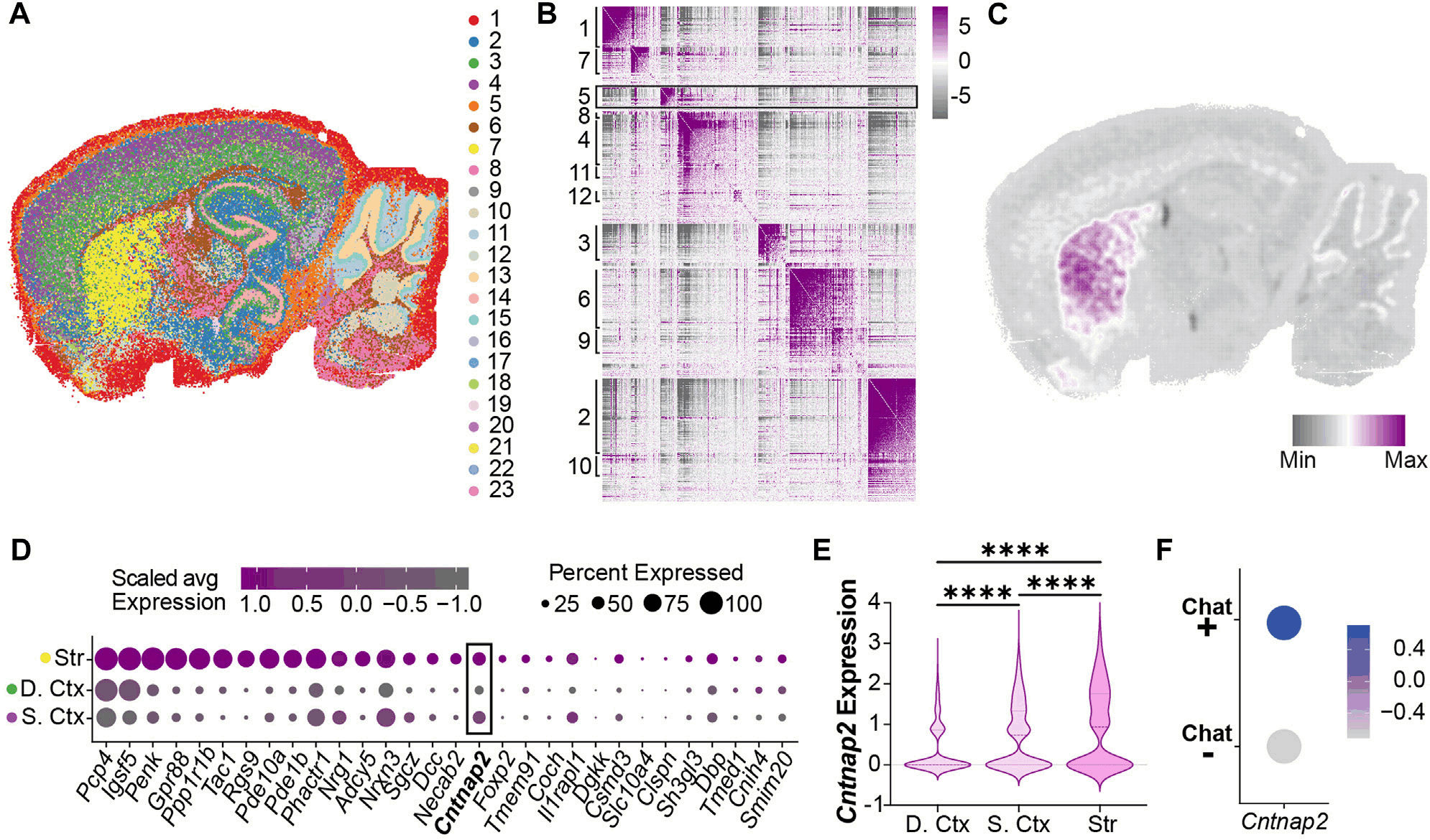 自闭症谱系障碍Cntnap2基因敲除小鼠模型中MGE衍生中间神经元的发育缺陷