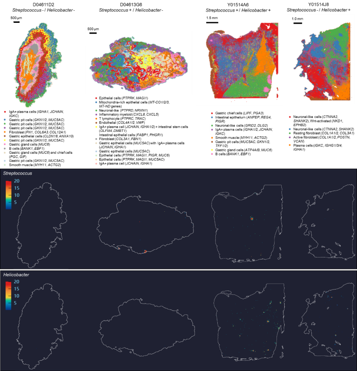 图5.胃癌组织中细菌序列的空间定位