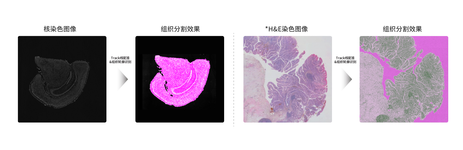 Go Optical拍摄的图像，均可经算法分析，与转录组捕获信息配准，进而实现组织分割。<br>*H&E染色图像来自哈尔滨医科大学附属肿瘤医院-许守平课题组提供的FFPE样本。