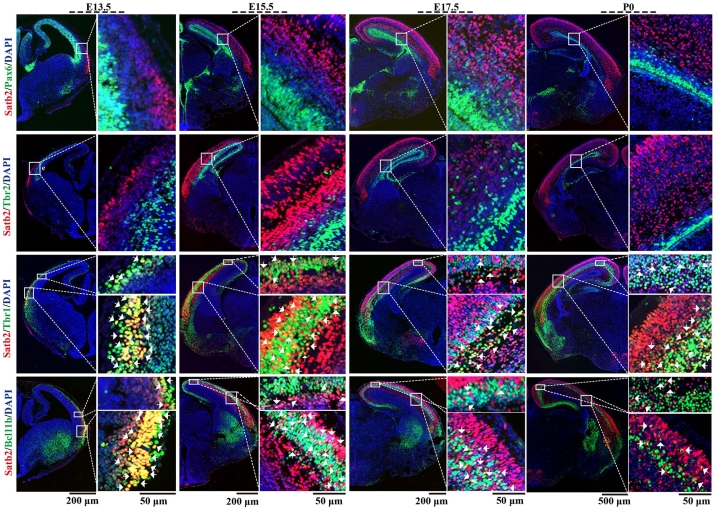 空间转录组揭示了 Satb2 在新皮层发育过程中调控的区域特异性基因和通路