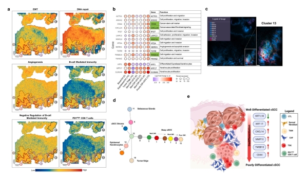 Unveiling intratumoral heterogeneity in high-risk cutaneous squamous cell carcinoma using single-cell spatial enhanced resolution omics-sequencing (Stereo-seq)