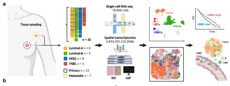 Spatially resolved atlas of breast cancer uncovers intercellular machinery of venular niche governing lymphocyte extravasation