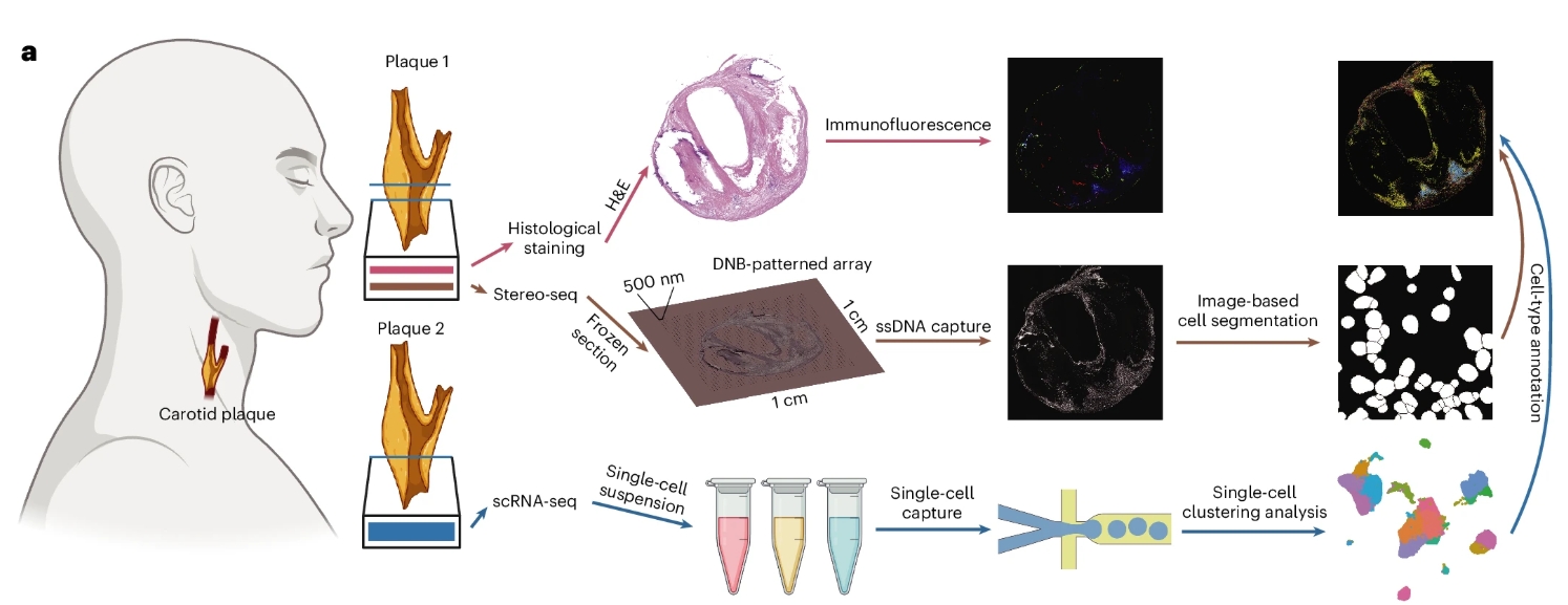 Single-cell spatial transcriptomics of tertiary lymphoid organ-like structures in human atherosclerotic plaques